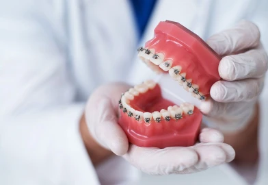 Malposition dentaire : la pose des appareils orthodontiques fixes à la clinique dentaire Trèfle d'Or à Lancy (1212)