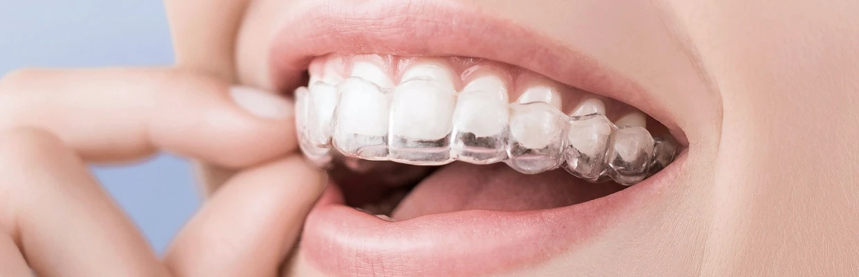 Orthodontie à la clinique dentaire Trèfle d'Or à Lancy (1212)