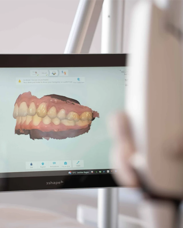 Technologies de la clinique dentaire Trèfle d'Or à Lancy : caméra intra-orale